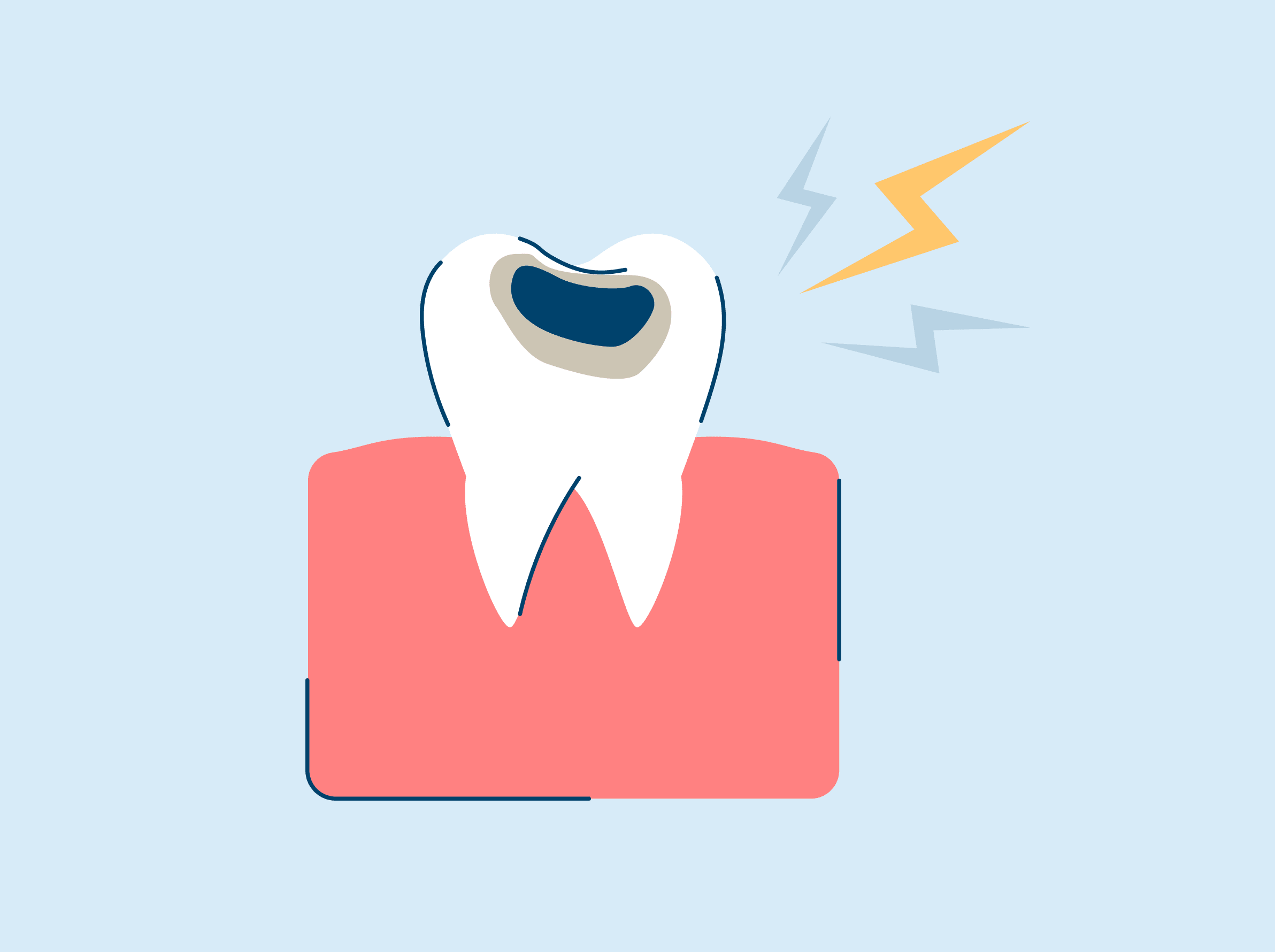 Cavity Pain Relief, Symptoms, and Causes SNOW® Oral Care