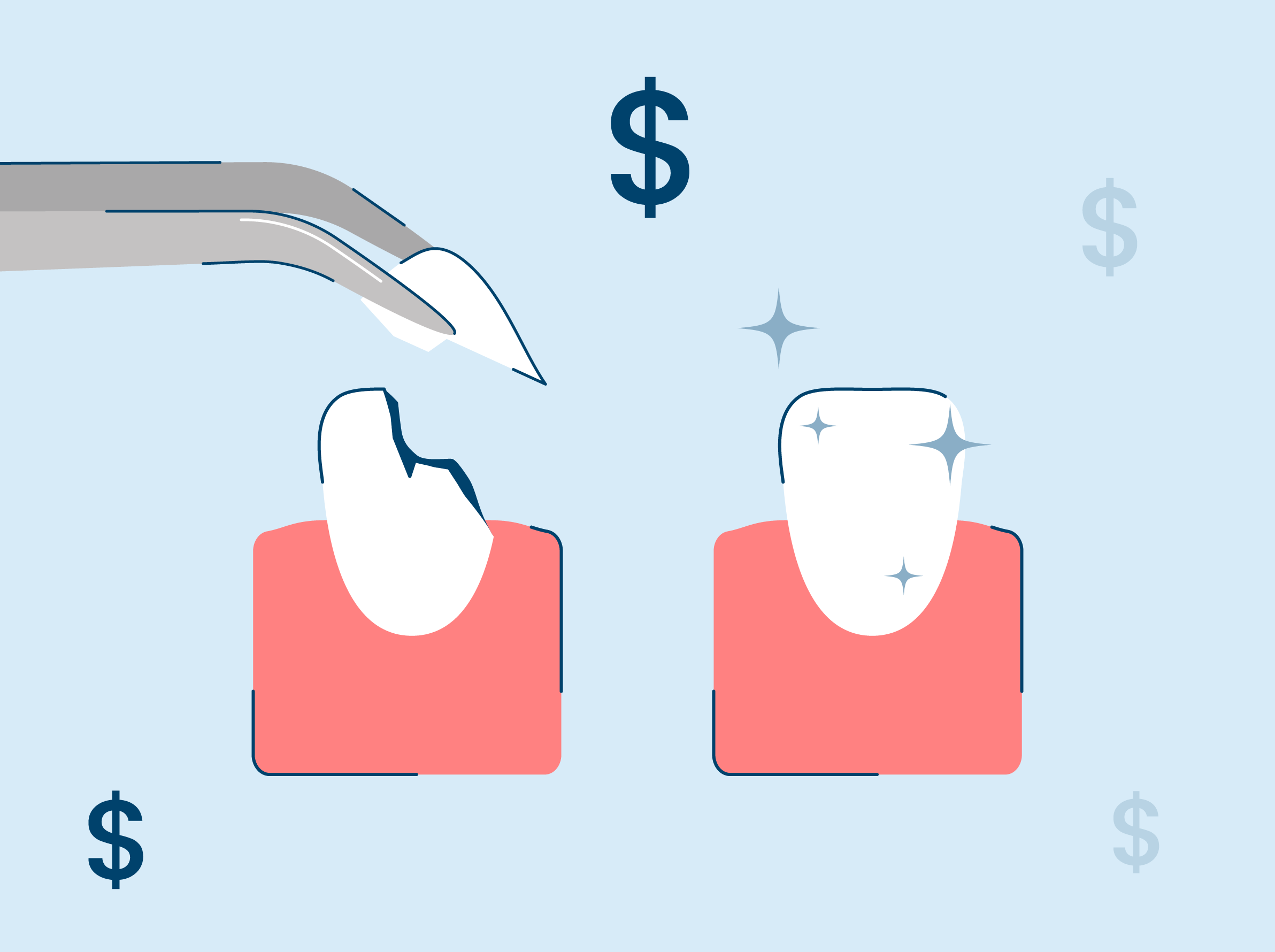 How Much Does It Cost to Fix a Chipped Tooth? SNOW® Oral Care