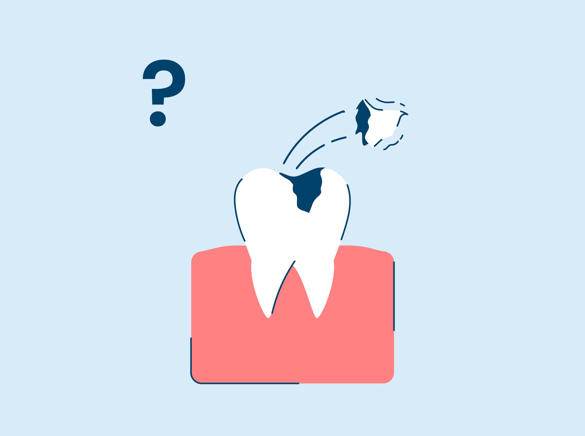 What To Do If Your Tooth Filling Fell Out SNOW® Oral Care