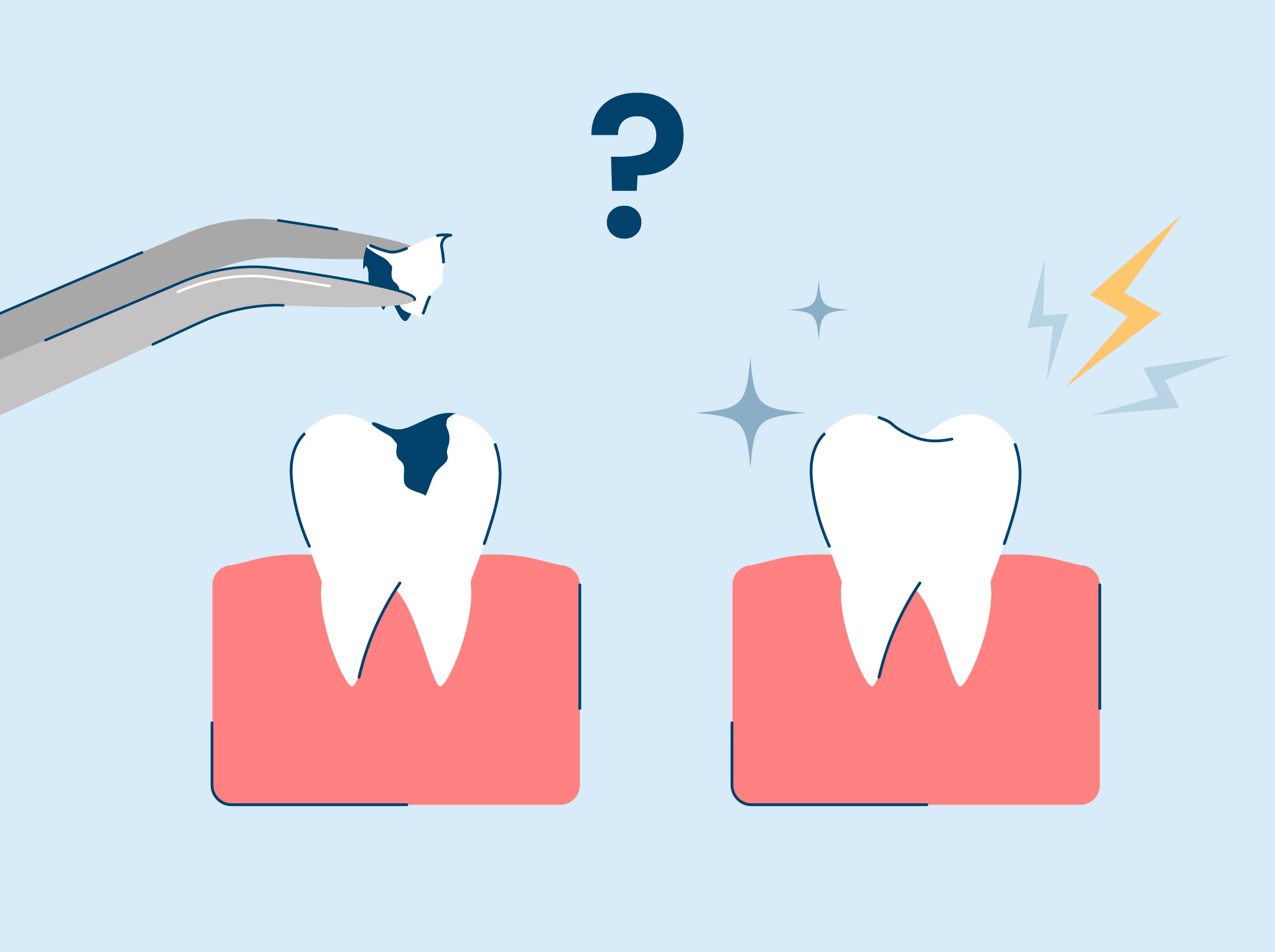What to Do If You Have Tooth Sensitivity After a Filling? SNOW® Oral Care