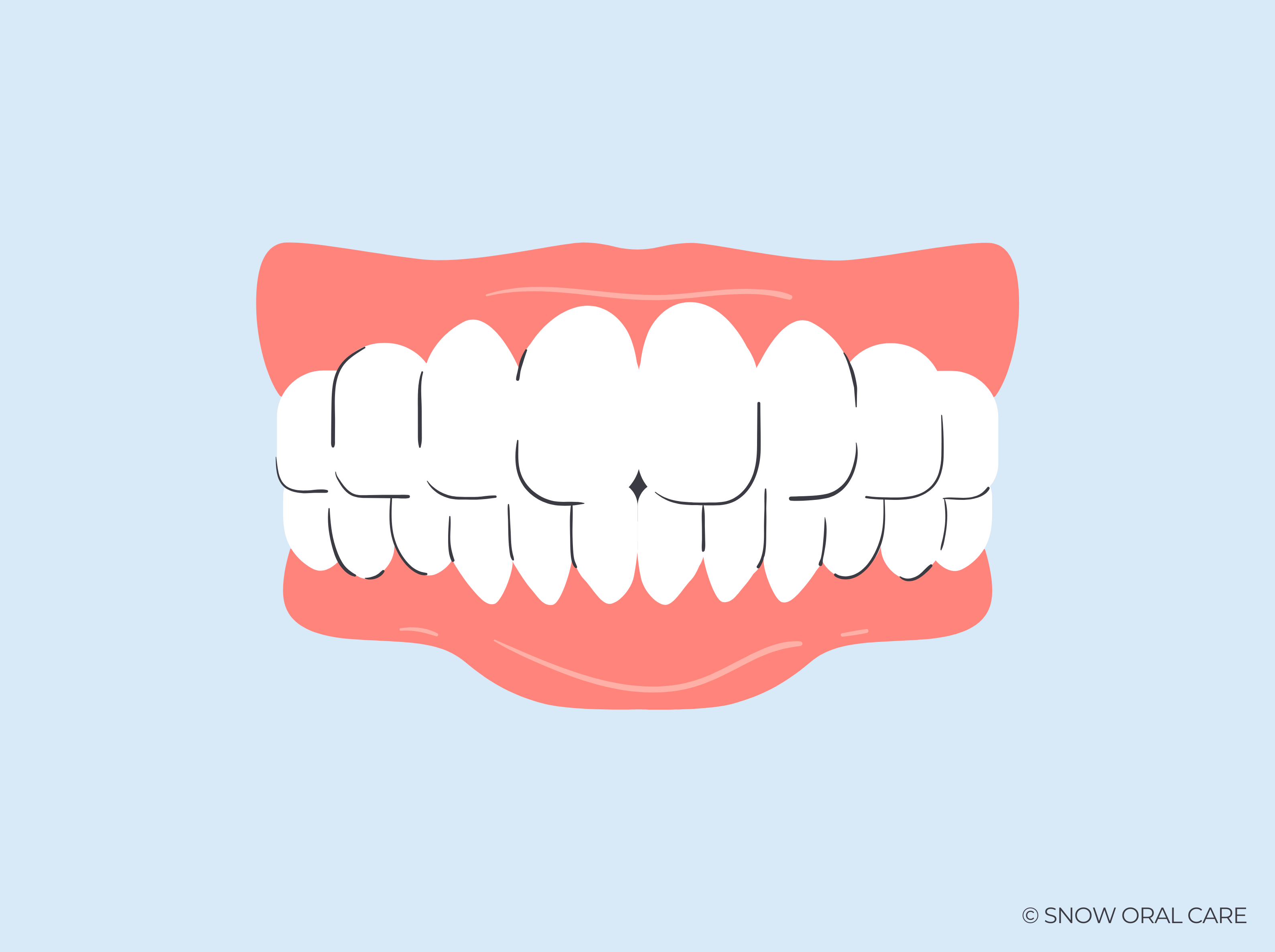 Can Teeth Whitening Cause Receding Gums? SNOW® Oral Care