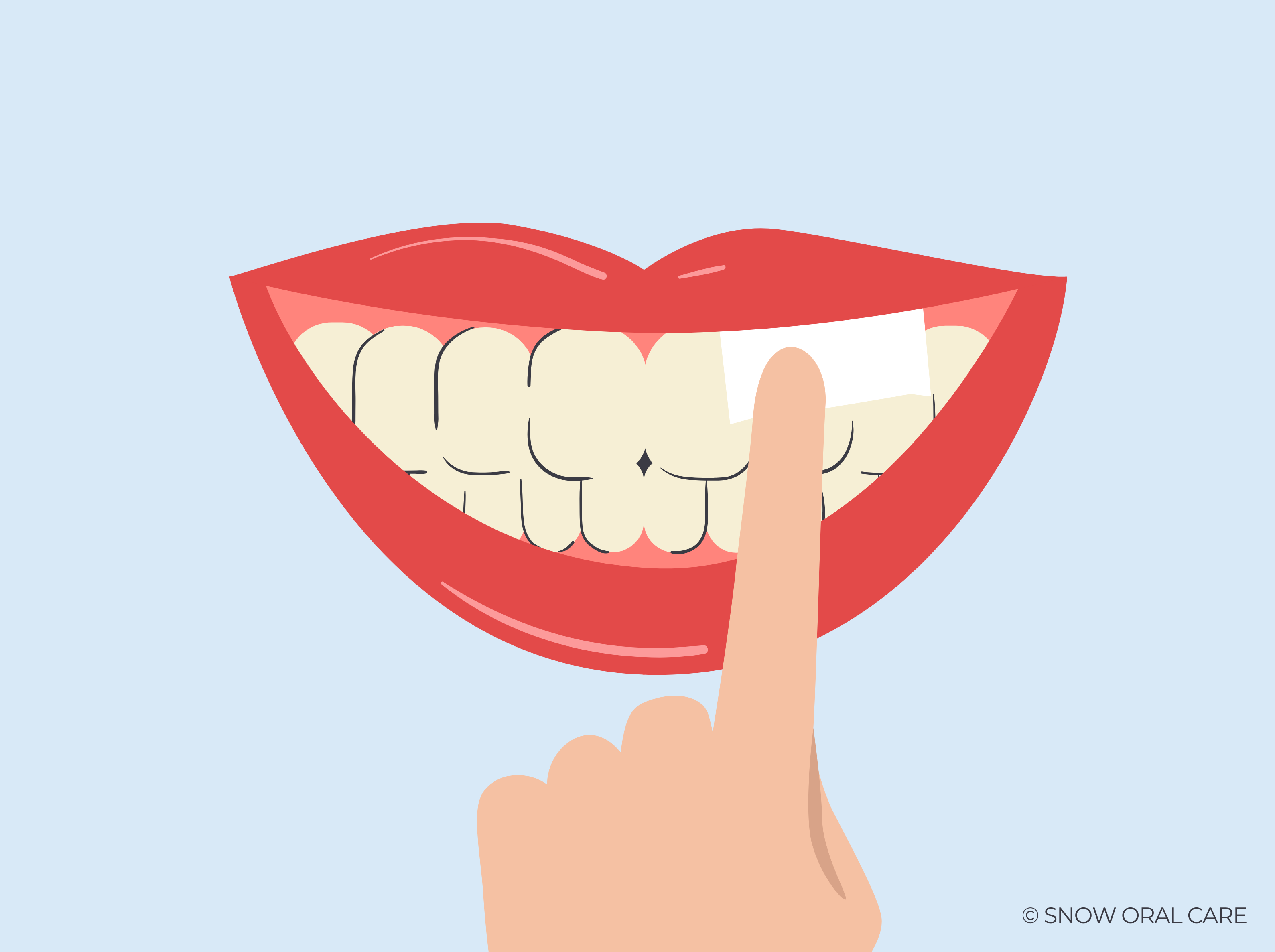 A) HOW DOES CHEWING TOBACCO STAIN TEETH? Your Teeth Have Pores Just Like Your Skin. The Nicotine And Tar In Tobacco Easily Absorbs Into These Pores Causing A Yellow Or Brown Discoloration