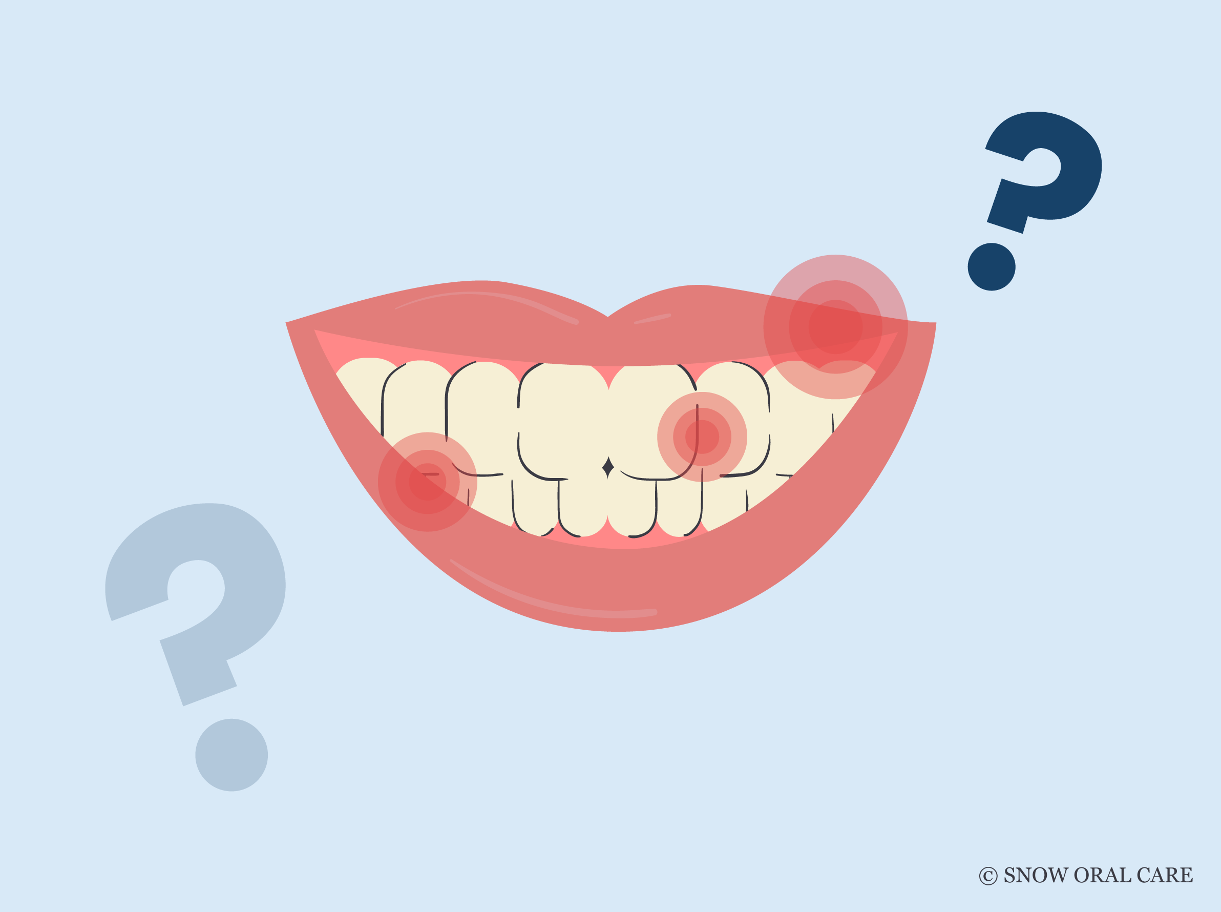 Does Teeth Whitening Hurt? SNOW® Oral Care