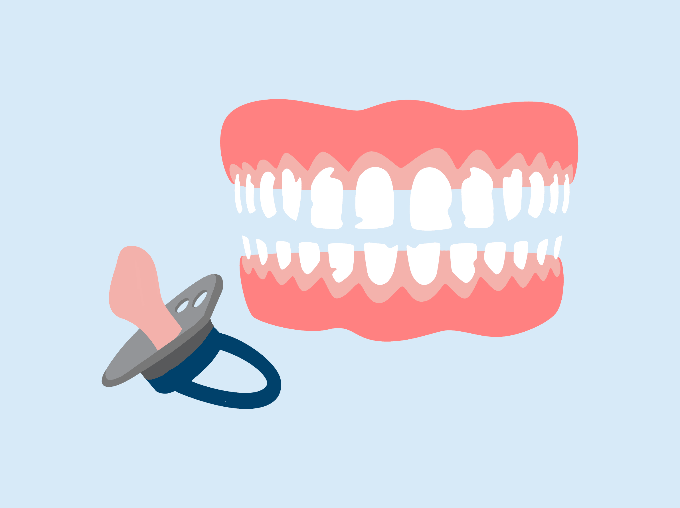 Illustration of teeth with a pacifier showing dental concerns