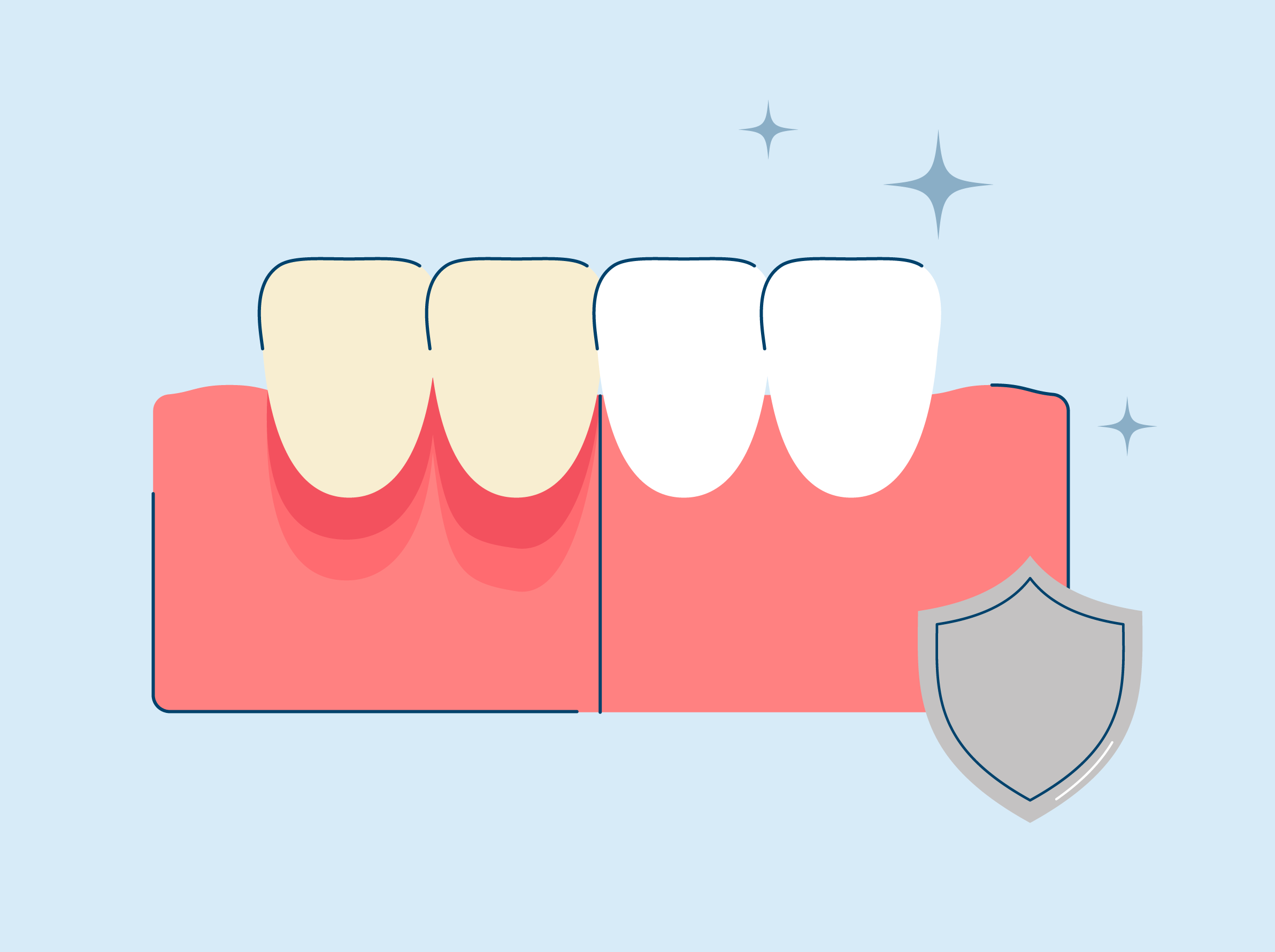How to Protect Gums During Teeth Whitening SNOW® Oral Care