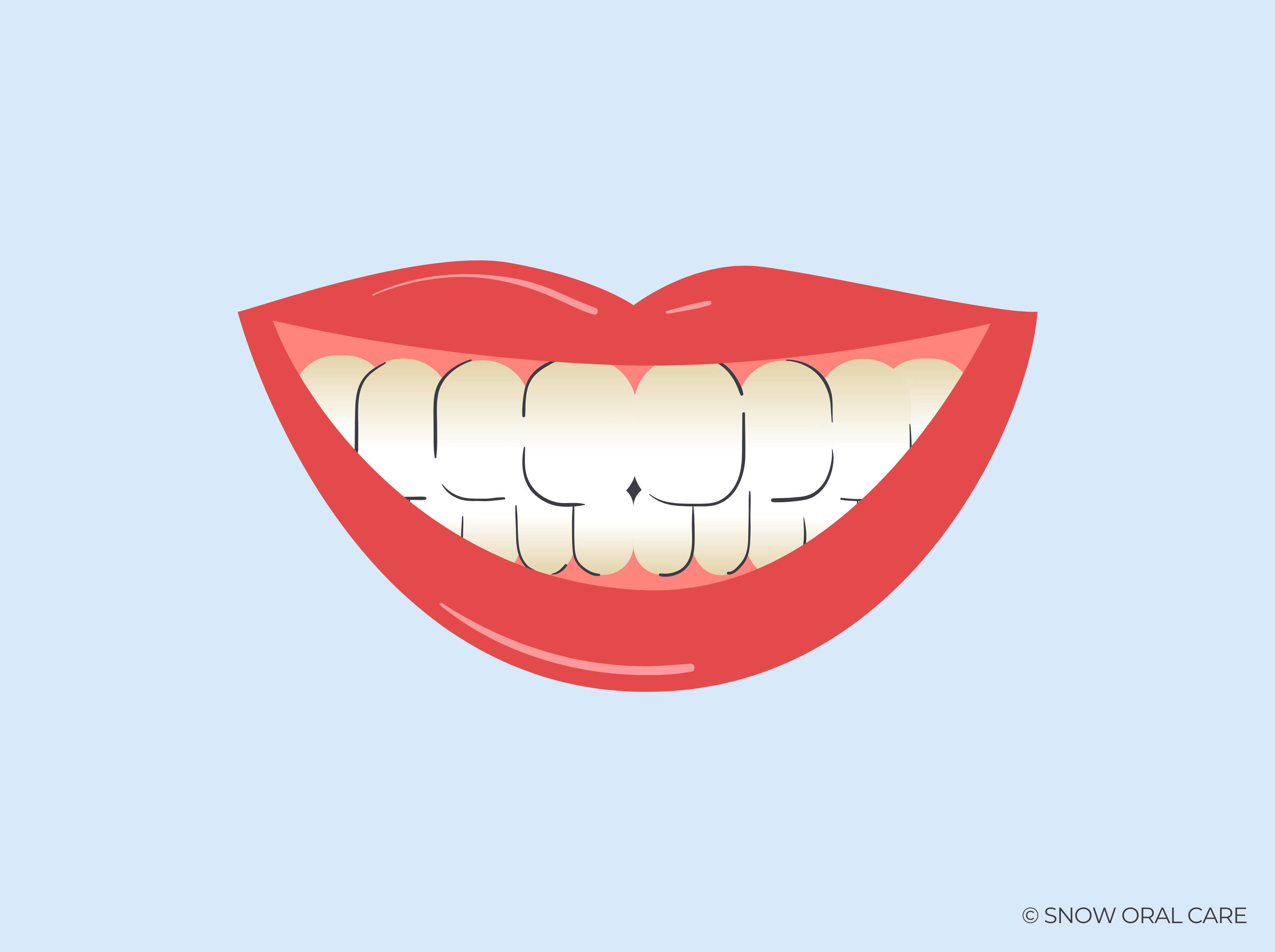 Teeth Not Whitening Near Gums SNOW® Oral Care