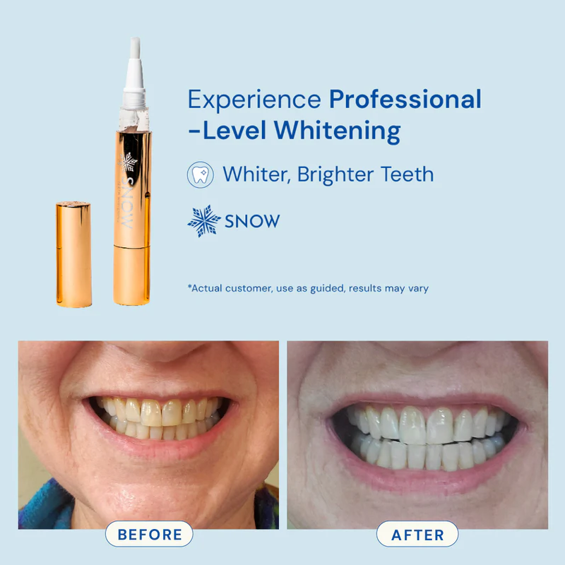 teeth-whitening-pen