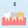How Much Do Dental Crowns (Caps) Cost?