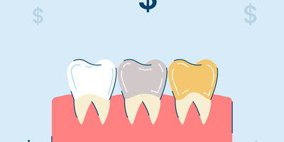 How Much Do Dental Crowns (Caps) Cost?