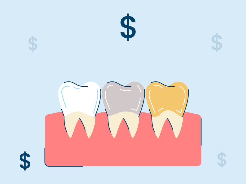 How Much Do Dental Crowns (Caps) Cost?
