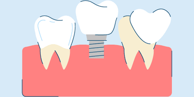 what is general dentistry