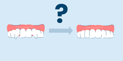 snaggle tooth