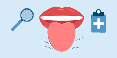 itchy tongue causes and treatment