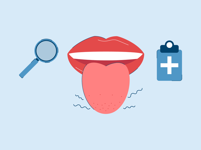 itchy tongue causes and treatment