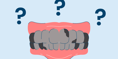 black teeth