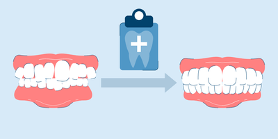 9 Ways to Get Crooked Teeth Fixed With Braces or Cosmetic Dentistry