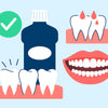 Best Mouthwash for Bleeding Gums: Top Picks for Healthier Gums