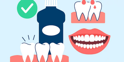 Best Mouthwash for Bleeding Gums: Top Picks for Healthier Gums
