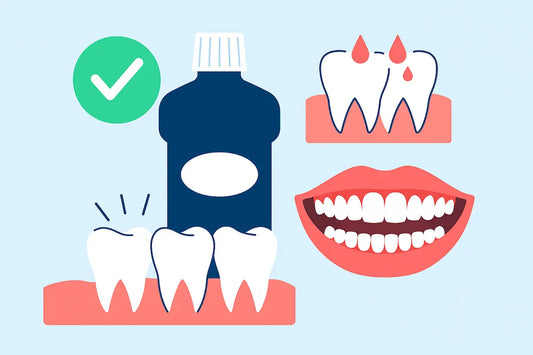Best Mouthwash for Bleeding Gums: Top Picks for Healthier Gums