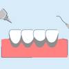 Black Tartar on Teeth: Causes, Symptoms, and Treatment