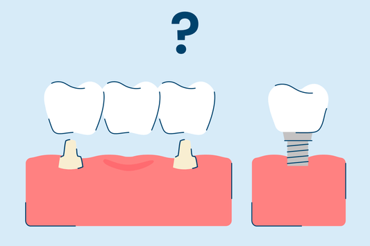 Bridge vs. Implant: What's The Difference?