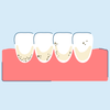 Brown Stains on Teeth: Prevention, Causes, and Treatment