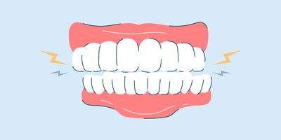 Bruxism (Teeth Grinding): Symptoms, Causes, and Treatments