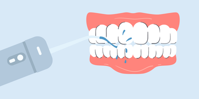can i use a water flosser after wisdom teeth removal 