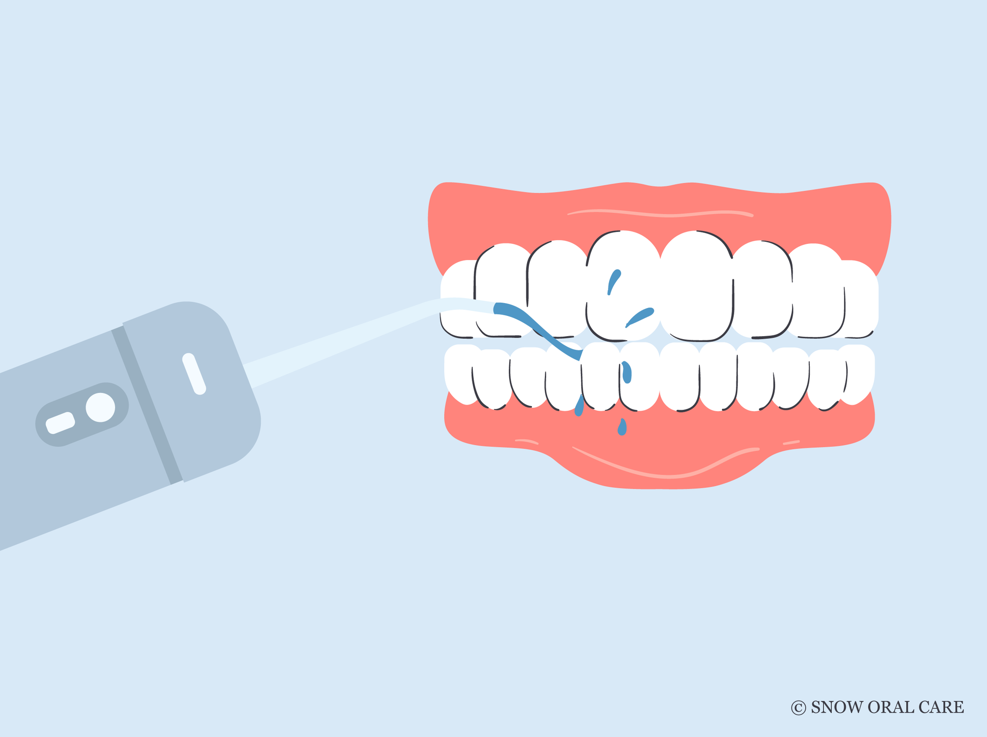 can i use a water flosser after wisdom teeth removal 