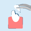 Chipped Tooth Causes and Repair