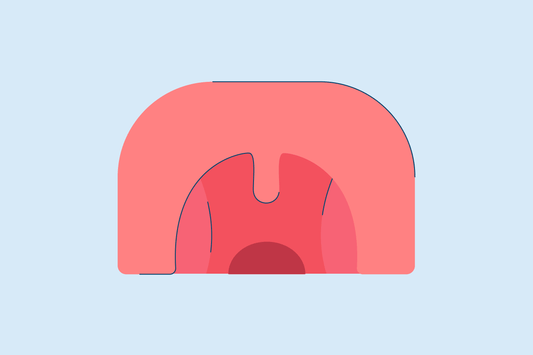 Cobblestone Throat: Causes and Treatment