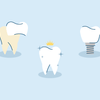 cosmetic dentistry procedures and costs