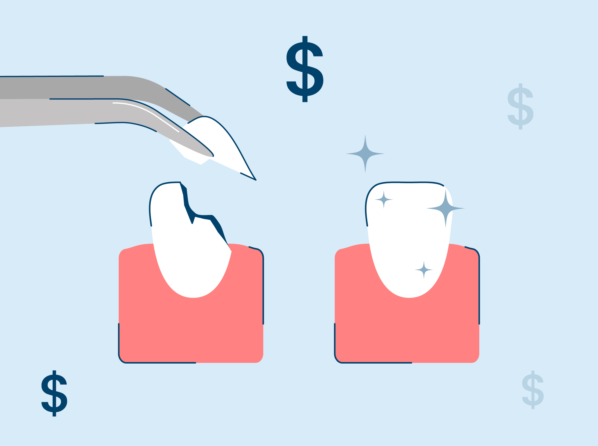 How Much Does It Cost to Fix a Chipped Tooth?