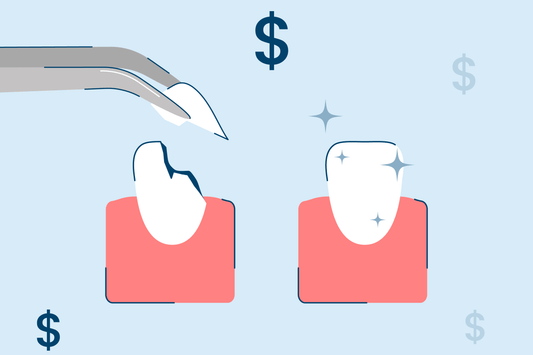 How Much Does It Cost to Fix a Chipped Tooth?