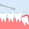 How Much Does Wisdom Teeth Removal Cost?