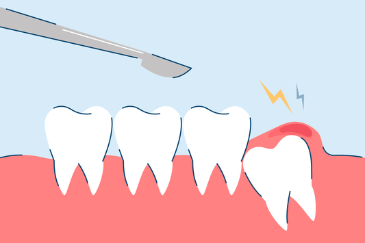 How Much Does Wisdom Teeth Removal Cost?