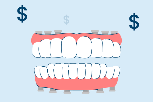 How Much Do Full Mouth Dental Implants Cost?