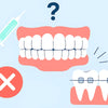 Does Whitening Interfere with Orthodontic or Invisalign Checkups?