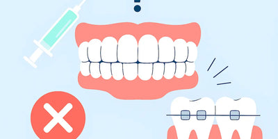 Does Whitening Interfere with Orthodontic or Invisalign Checkups?