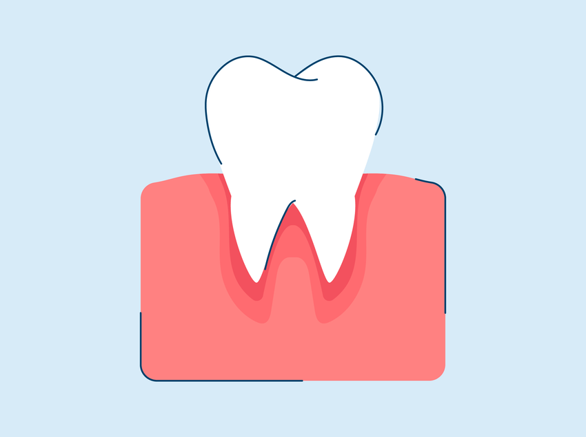 Gum Infection: Causes, Symptoms, and Treatment