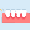 Pain in Gums? Here's How to Find Relief.