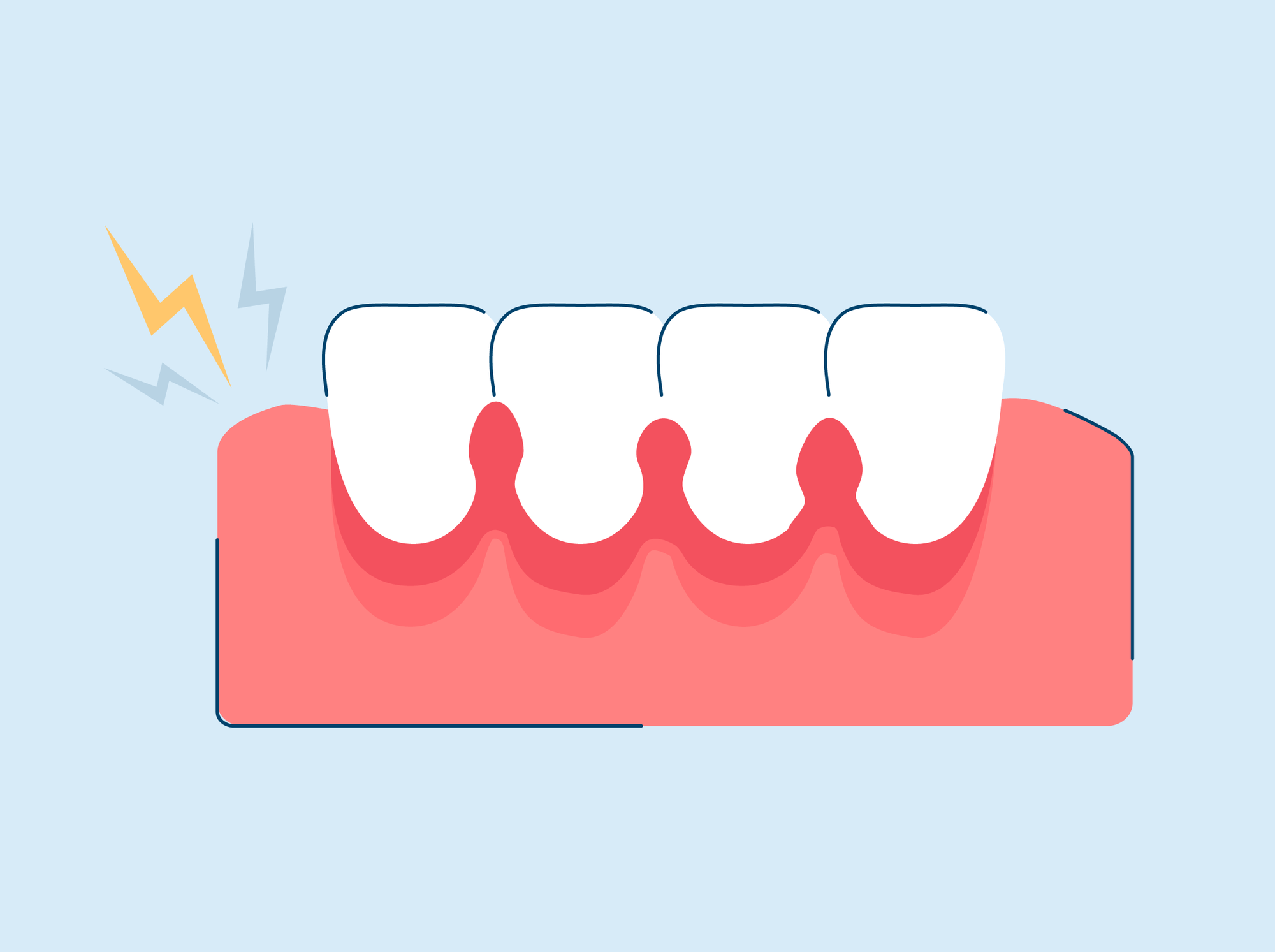 Pain in Gums? Here's How to Find Relief.