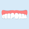 How to Fix a Chipped Tooth at Home