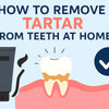 Effective Ways on How to Remove Tartar from Teeth Without a Dentist