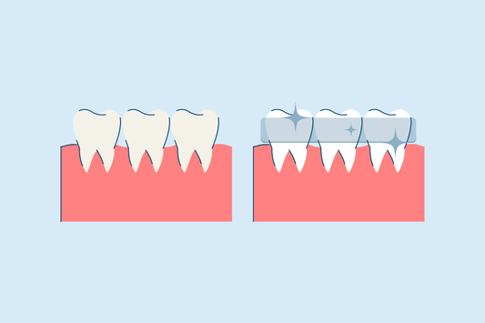 snow guide on how to use teeth whitening strips