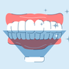 Is UV Teeth Whitening Safe?