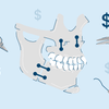 4 Types of Orthognathic Surgery: Procedure and Costs