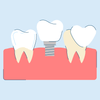 Restorative Dentistry: Procedures and Treatments