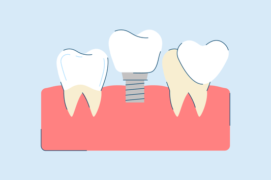 Restorative Dentistry: Procedures and Treatments