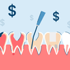 How Much Does a Root Canal Cost?